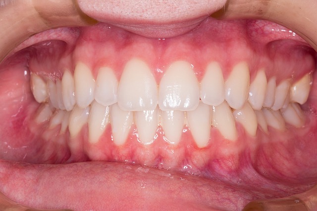 cosmetic dentist in Baton Rouge